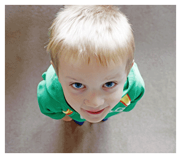 boy with APD CAPD